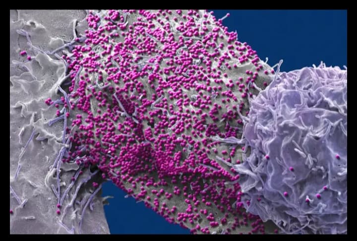 رجل يُشفى بشكل غير متوقع من فيروس نقص المناعة البشرية بعد زراعة خلايا جذعية