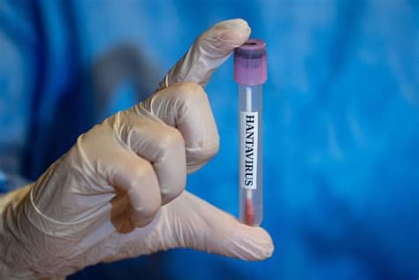 One US Citizen Tests Mildly Positive for Hantavirus; Another Exhibits Mild Symptoms