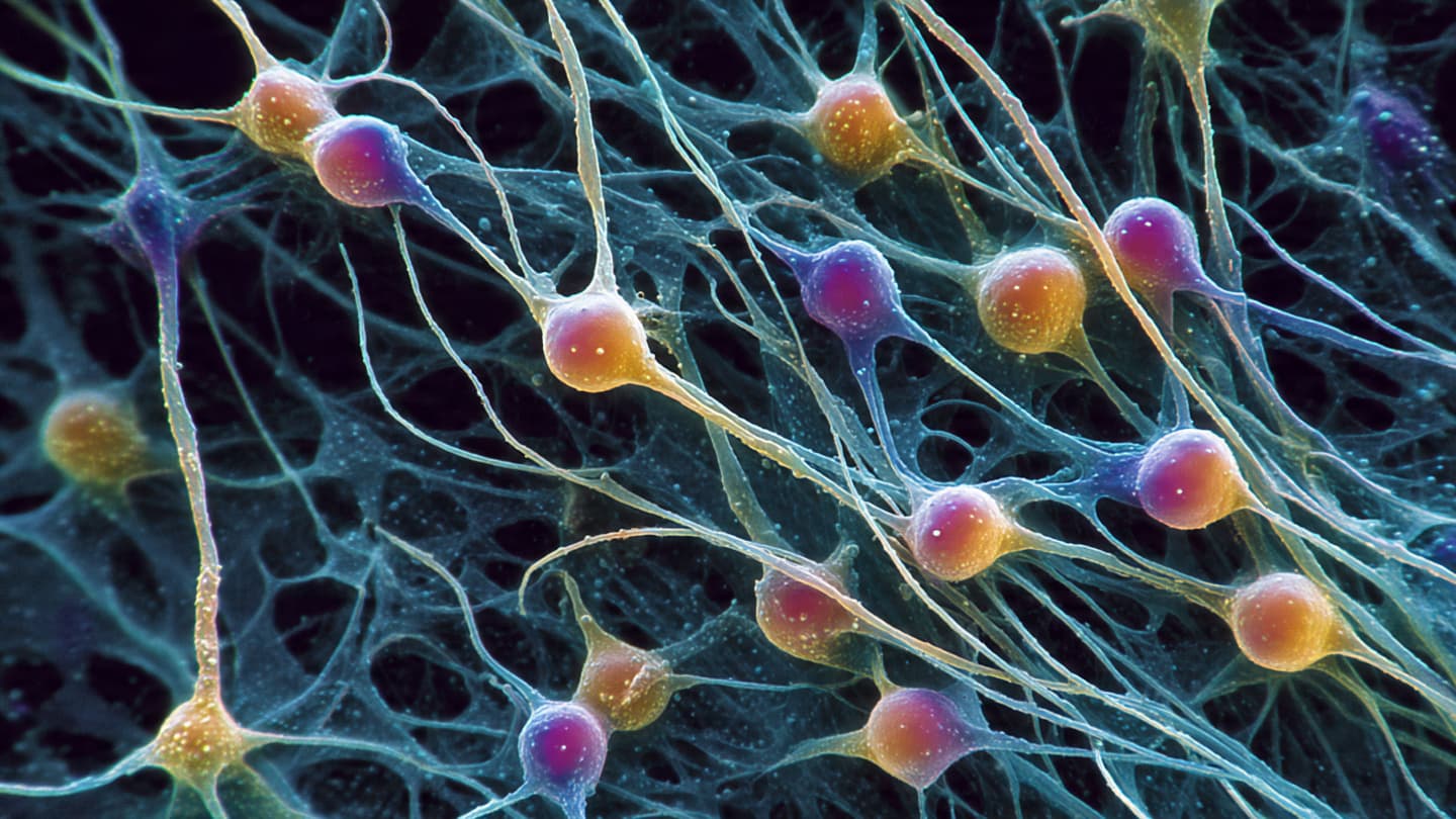 The Brain’s Wires May Never Have Been Straight