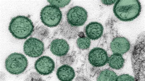 Australians from Hantavirus Cruise Ship to Fly Out of Netherlands in Full PPE After Plane and Crew Secured