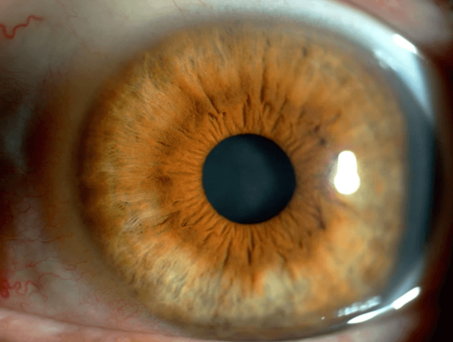 Eye drops made from pig semen deliver cancer treatment to mice