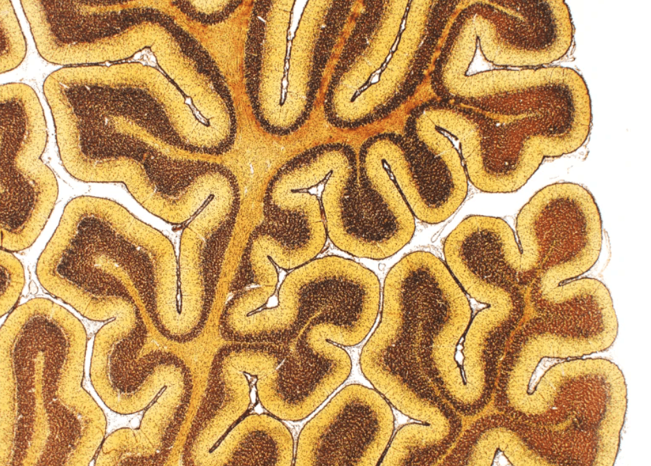 First atlas of brain organization shows development over a lifetime