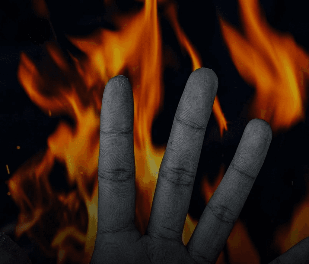 Shock in Srinagar: Woman Hospitalized After Setting Herself Ablaze in Lal Chowk