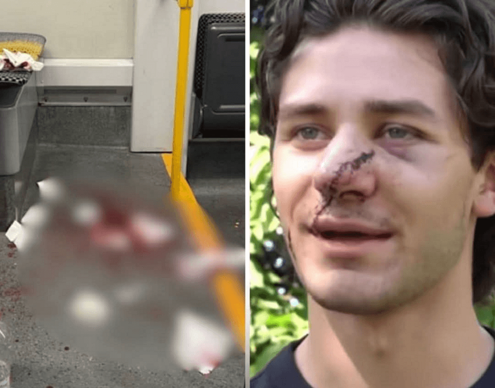 Hero on the Rails: Tourist Steps In to Stop Brutal Assault on German Tram